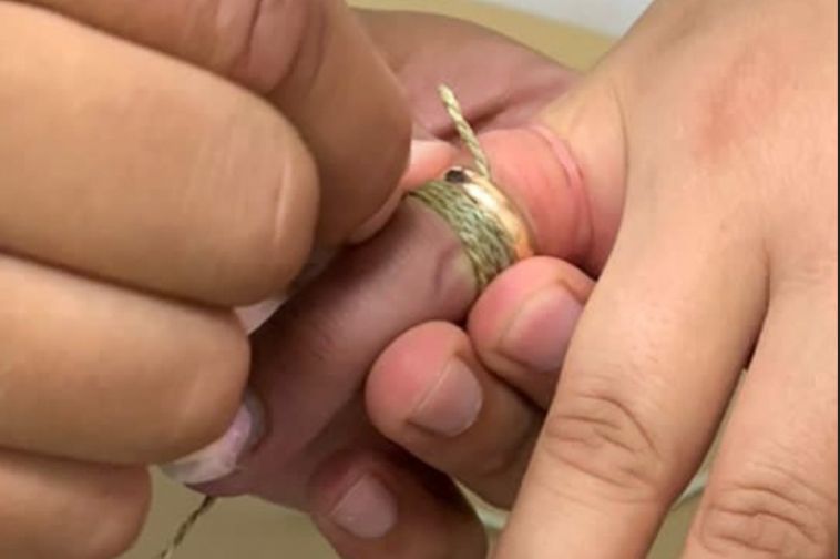 В Миассе спасатели сняли кольцо с пальца беременной женщины