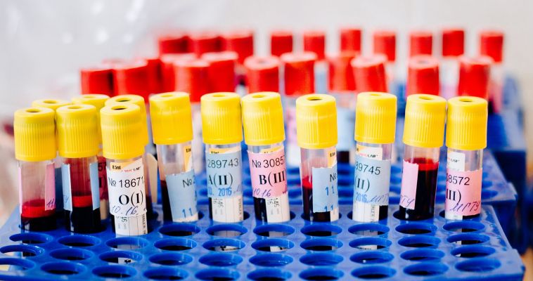 Магнитогорцы смогут сдать экспресс-тест на ВИЧ