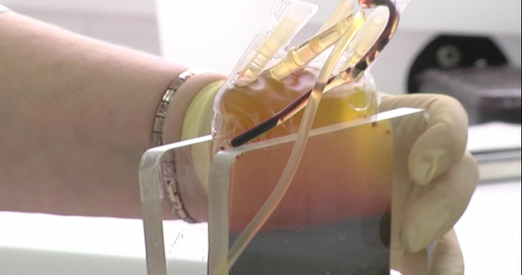 21 ребёнок в Магнитке заразился ВИЧ-инфекцией за последние два года