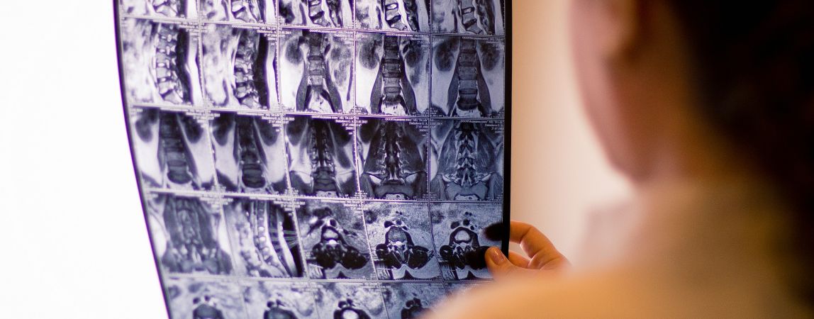 Травмироваться стали чаще. Причина - весенний гололед