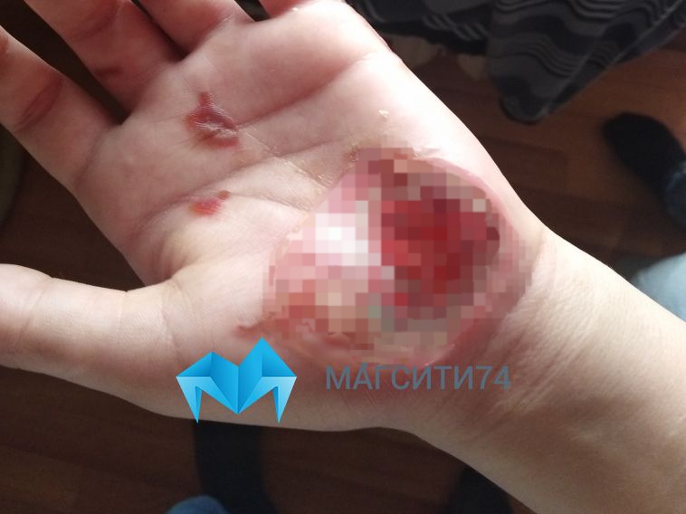 «Облили кислотой»: жительница Магнитогорска пожаловалась на жестокое наказание за кражу консервы